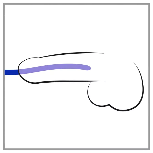 You2Toys - διαστολέας ουρήθρας - σετ σιλικόνης 3 τεμαχίων